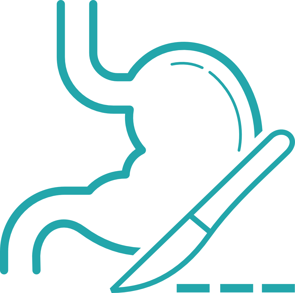 Best Surgical Gastroenterology Hospital in Bangalore