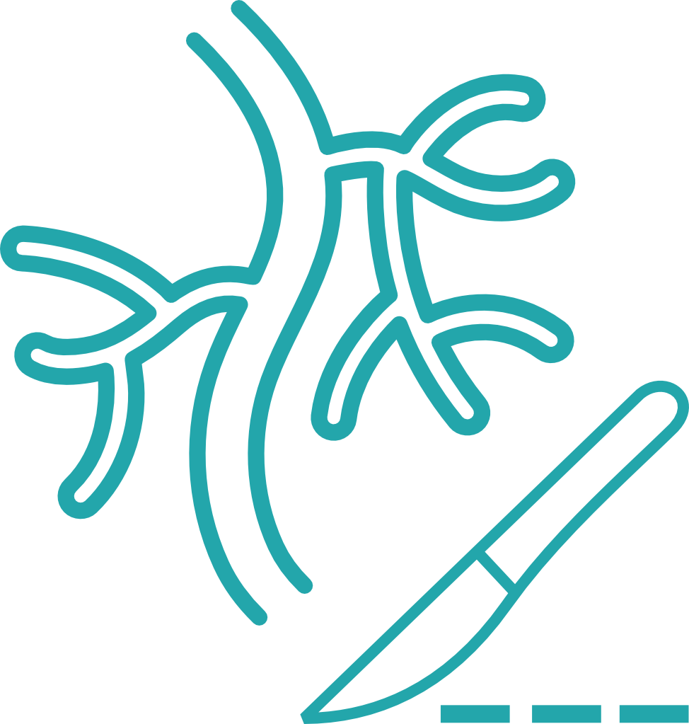 Vascular and Endovascular surgery